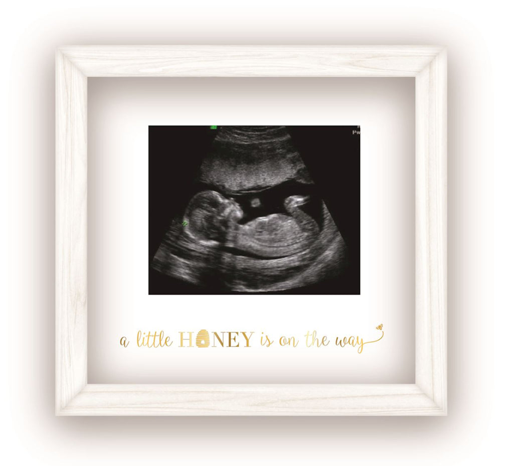 Ultrasound Baby Frame